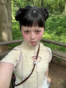 装具無しで歩けるようになった！