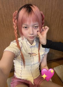 赤面症はかわいい❤︎